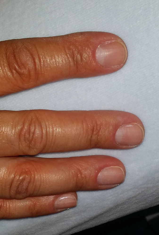 meski manicure przed small